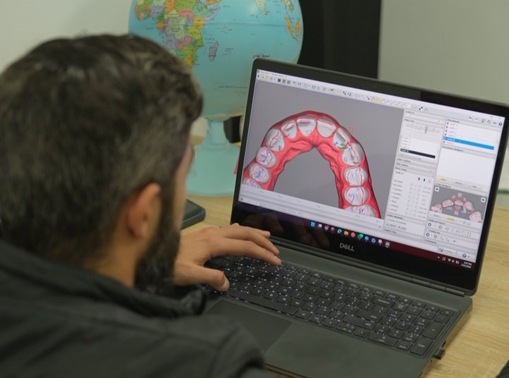 3D treatment simulation software